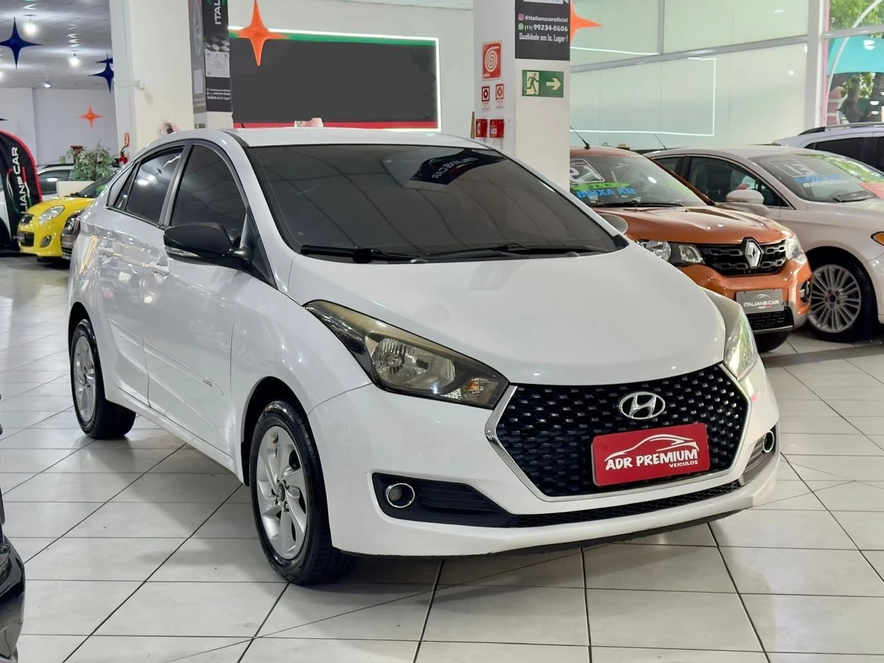 HYUNDAI HB20S