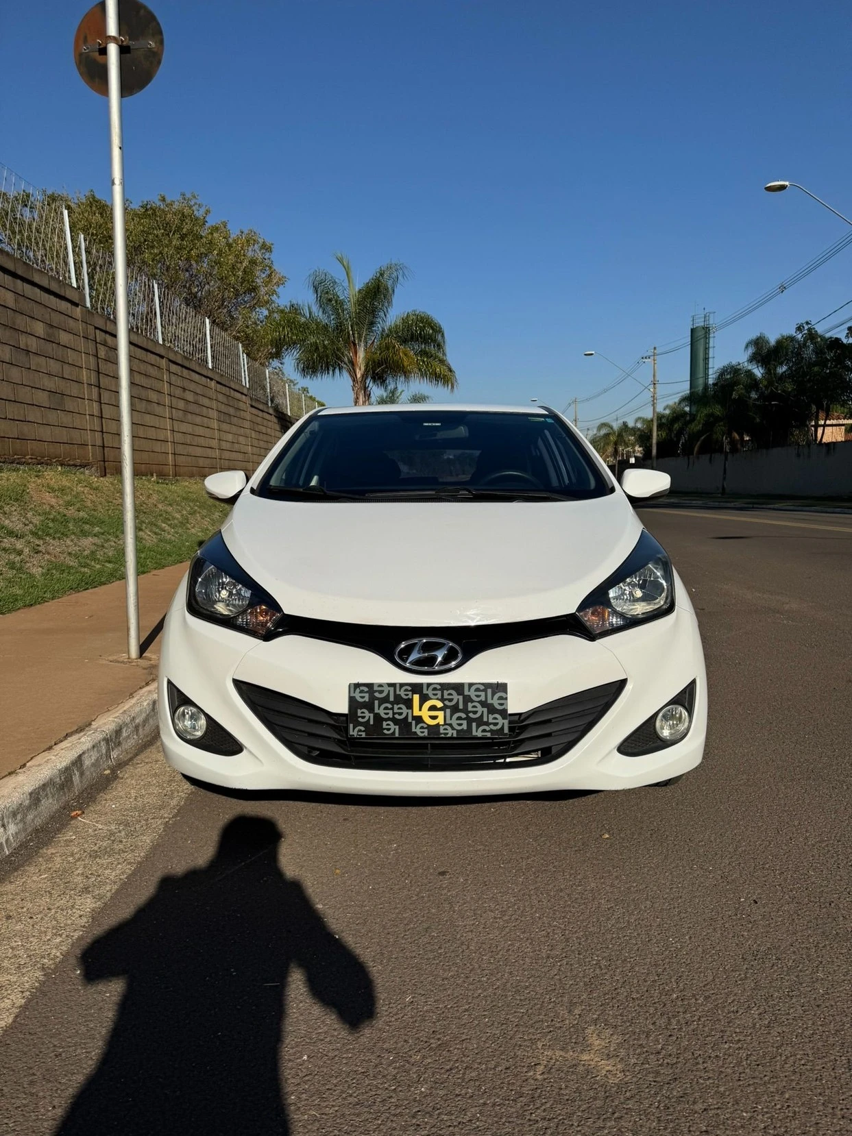 HYUNDAI HB20