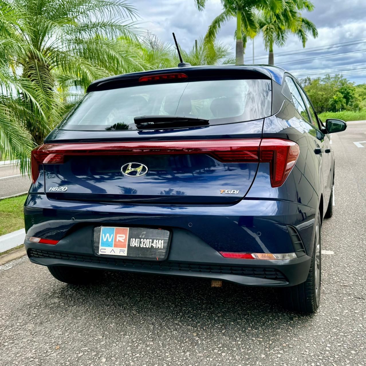 HYUNDAI HB20